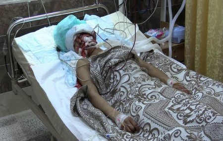150 мирных жителей погибло с начала операции в Африне