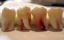 В США нашли тысячу человеческих зубов, замурованных в стену (ФОТО)