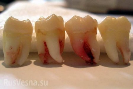 В США нашли тысячу человеческих зубов, замурованных в стену (ФОТО)